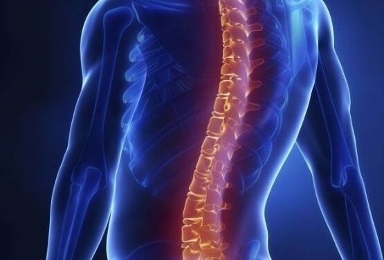 Ortho Neurological Disorders